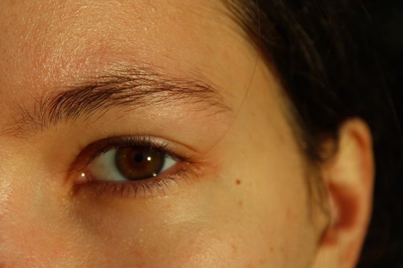Cara menghilangkan flek hitam dengan Niacinamide